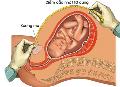 Quy trình khám thai mà các mẹ bầu cần thiết